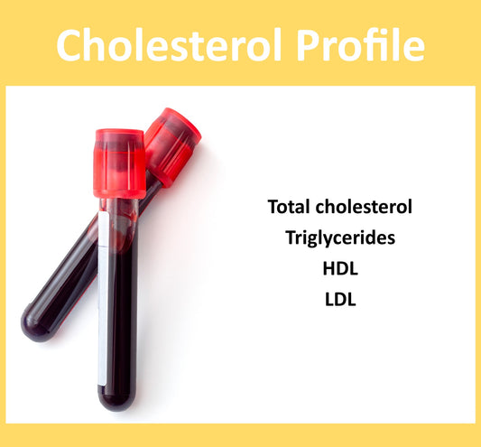 Cholesterol Lipid Profile