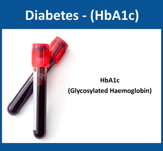 Diabetes - Diagnosis and Monitoring (HbA1c)